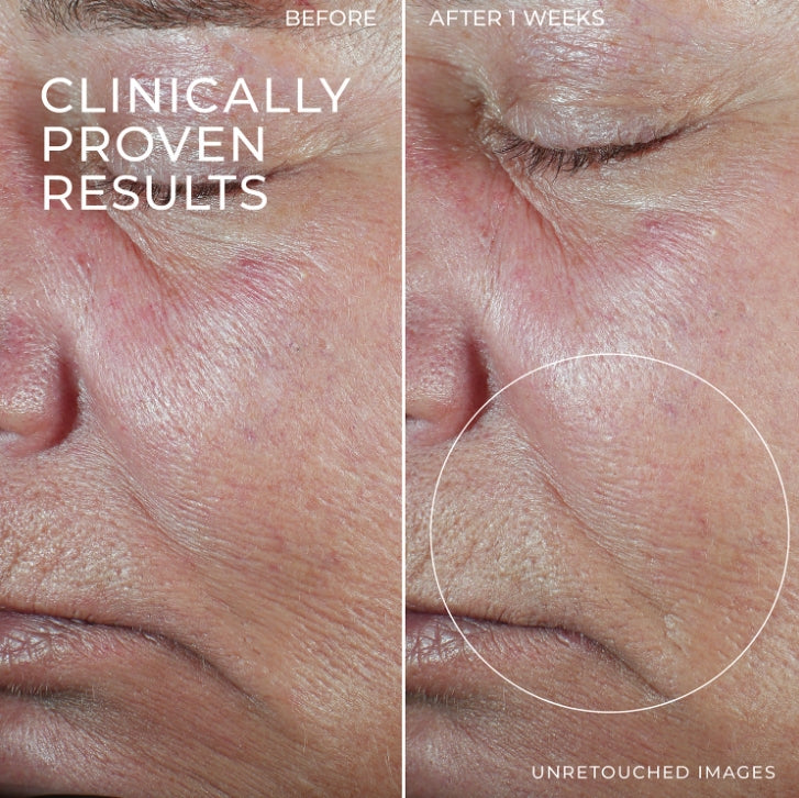 Seurico⢠Festigungsserum-Stick