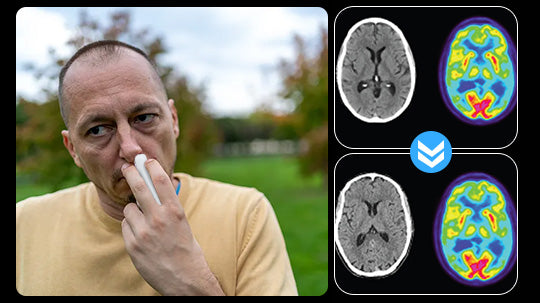 NeuroMist-Memory-Boost(treat Alzheimer's disease)