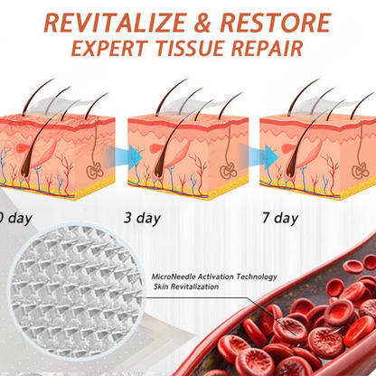 【Last Day Promotion 80% OFF】FDA Official: Seurico™ Vein Ease Microneedle Care Patch(For Spider Veins, Varicose Veins, Swelling & Leg Fatigue)