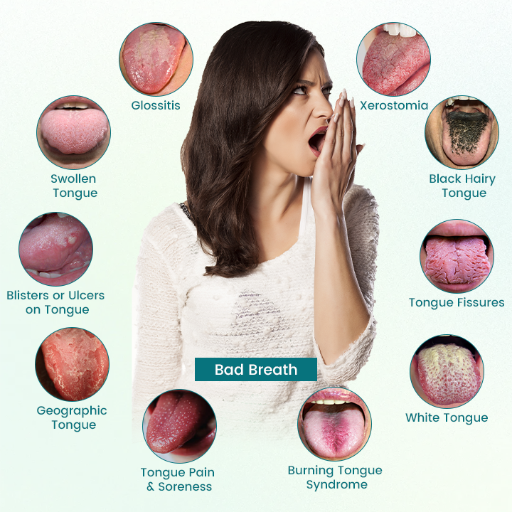 Timiilk® GlosShield Tongue Repair Spray: Fast, Natural Relief for Oral Discomfort