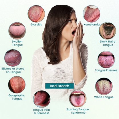 Timiilk® GlosShield Tongue Repair Spray: Fast, Natural Relief for Oral Discomfort