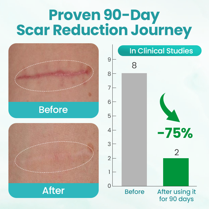 Seurico® EliteAloe ScarSolve Spray