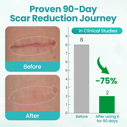 Seurico® EliteAloe ScarSolve Spray