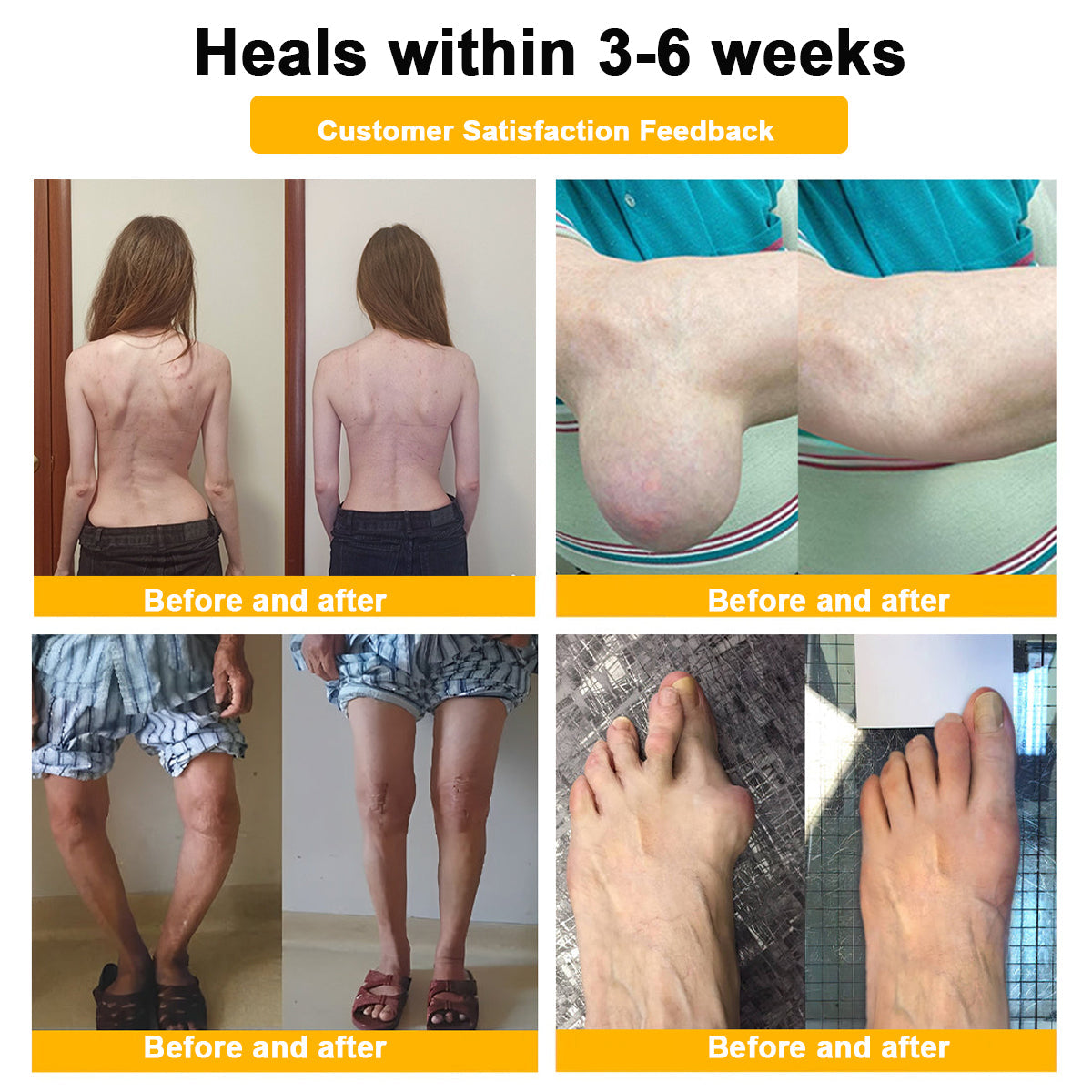 Seurico™ Botulinum Toxin & Bee Venom Pain-Relief Bone Healing Cream (Copy)