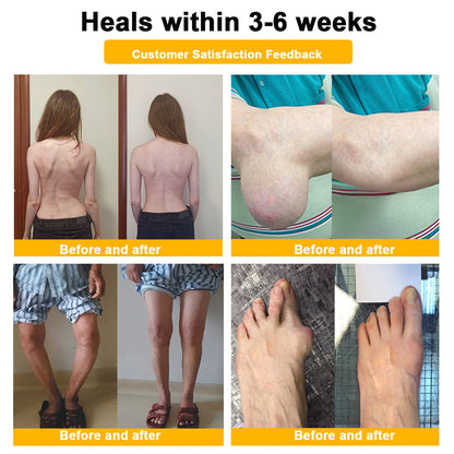 Seurico™ Botulinum Toxin & Bee Venom Pain-Relief Bone Healing Cream (Copy)