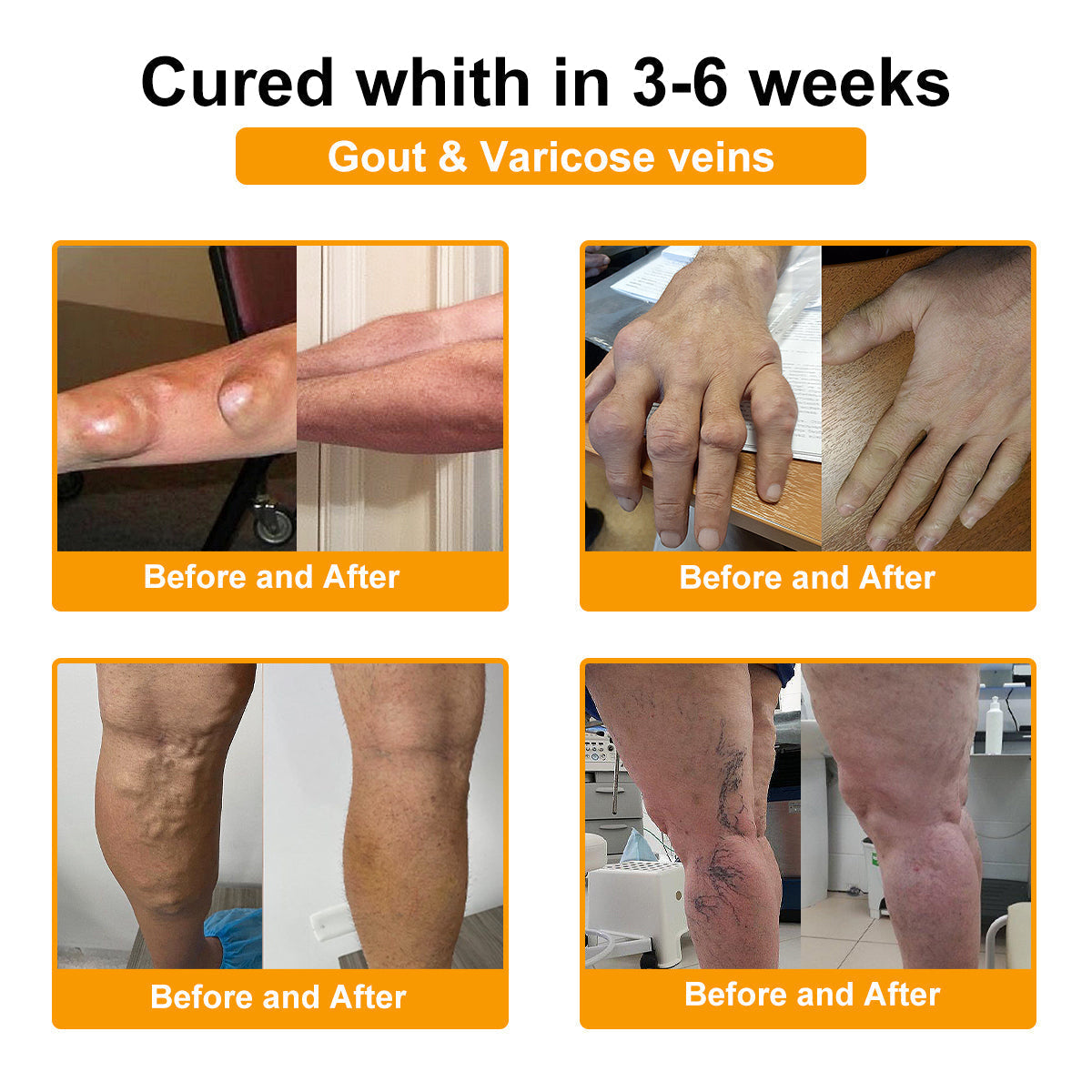 Seurico™ Botulinum Toxin & Bee Venom Pain-Relief Bone Healing Cream (Copy)