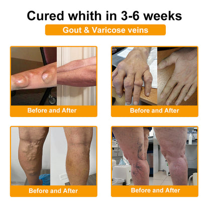 Seurico™ Botulinum Toxin & Bee Venom Pain-Relief Bone Healing Cream (Copy)