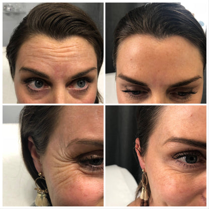 Seurico™™ Power Redo Anti-Aging Blur & Smooth Wrinkle Filler-Last Day Sale 90% OFF 🔥Buy 1 Get 2 Free🔥