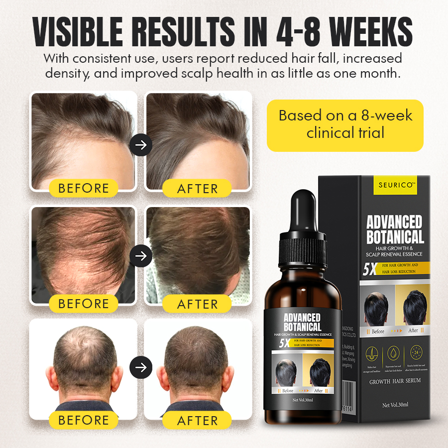 🌱Seurico™ Advanced Botanical Hair Growth & Scalp Renewal Essence