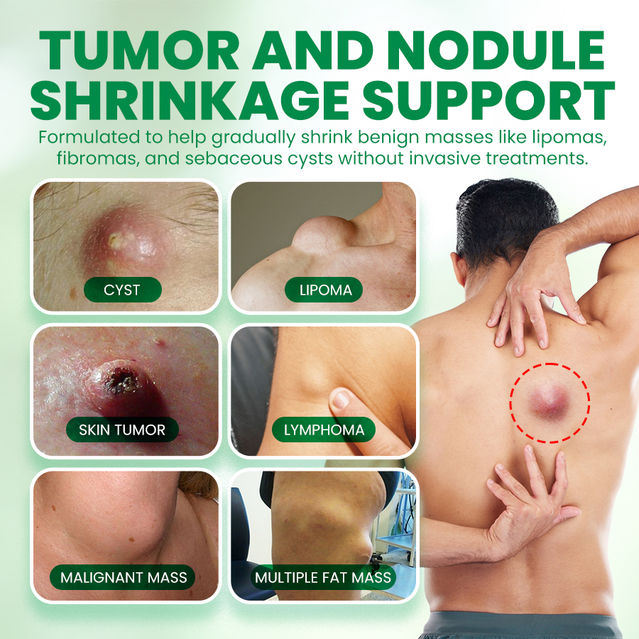 NEGUSY™Advanced Lipoma & Nodule Treatment Cream