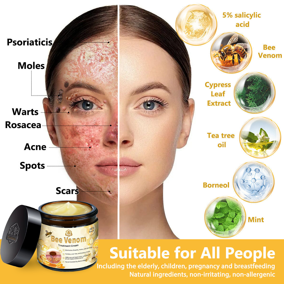 𝗧𝗟𝗢𝗣𝗔® Bee Venom Skin Treatment Cream (AAD Recommended👨‍⚕️)💖💟