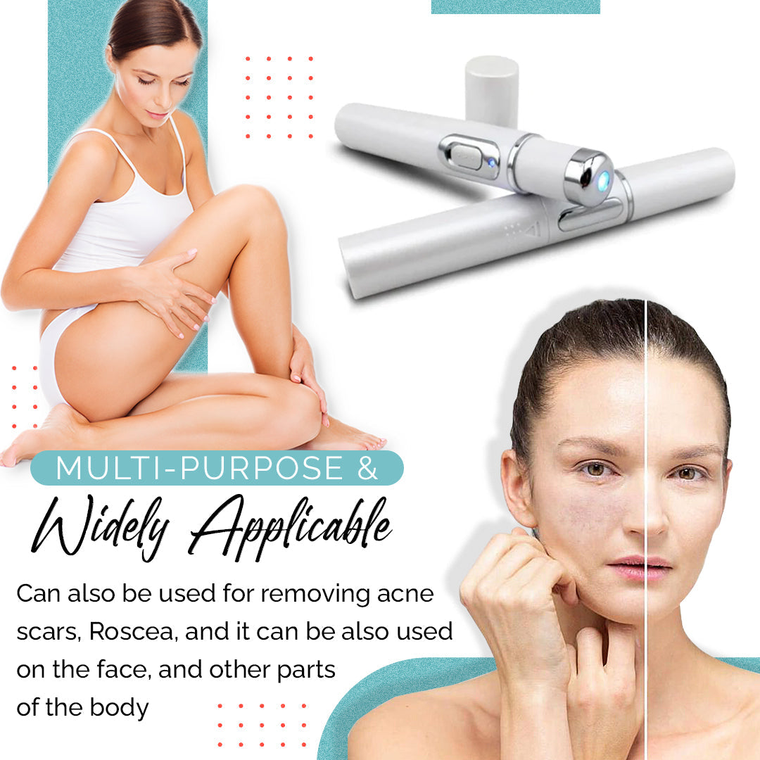 VariLuxe Varicose Veins Blue Light Treatment Pen
