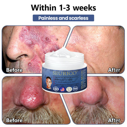 Seurico™ Snail Mucin Skin Treatment Cream (AAD Recommended👨‍⚕️)💖💟