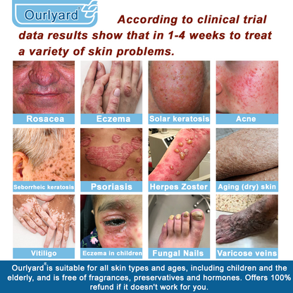 🏆✅Mayo Clinic Official: Magnesium skin repair cream (Eczema and Psoriasis Relief, Skin Repair, Even Tone, Acne and Dark Spot Treatment, Wart and Mole Removal)