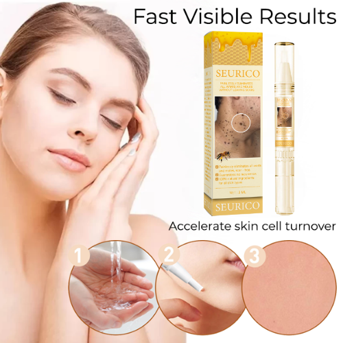 🐝Last Day Promotion 49% OFF Seurico™ Bee Venom Wart Removal Pen