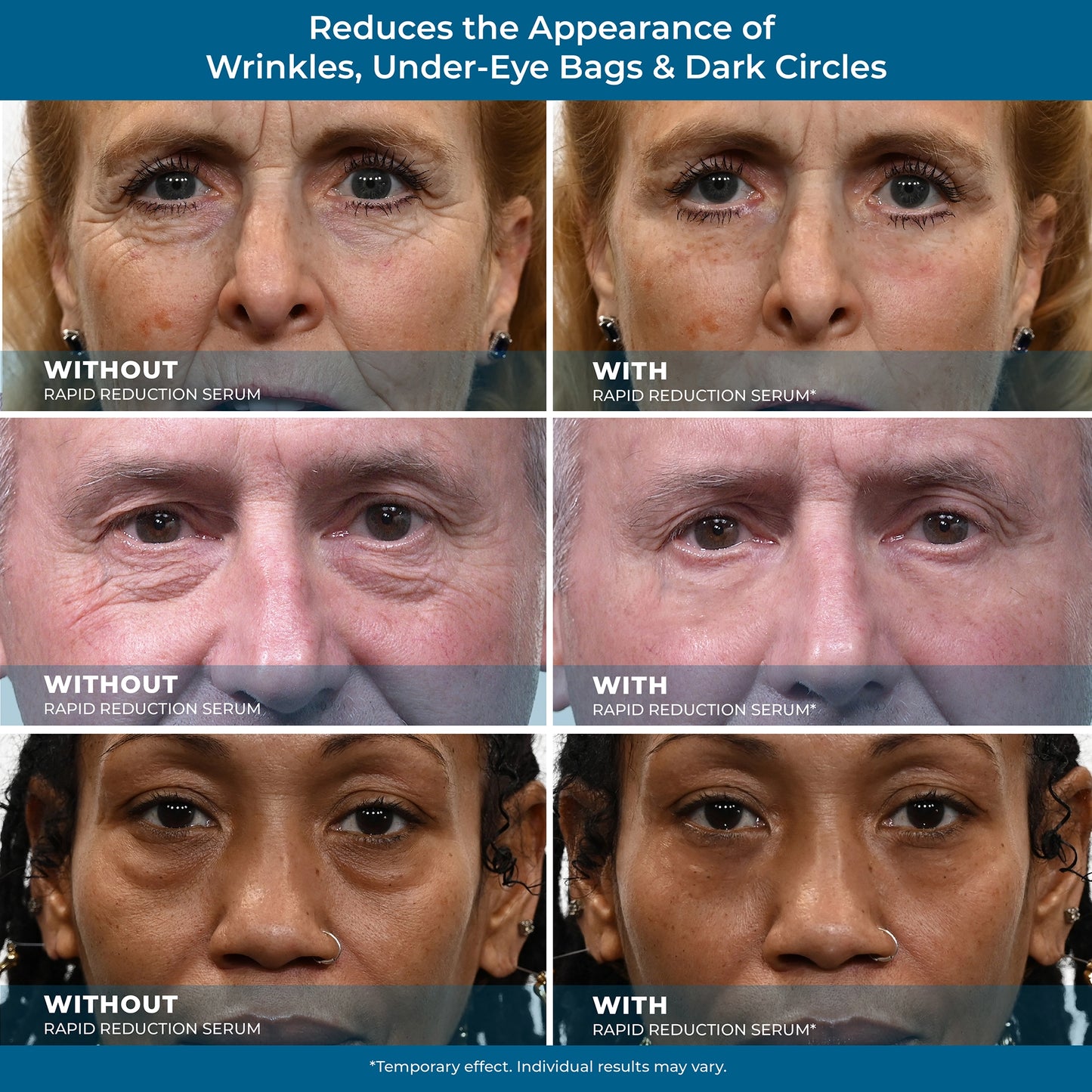 Rapid Reduction Serum