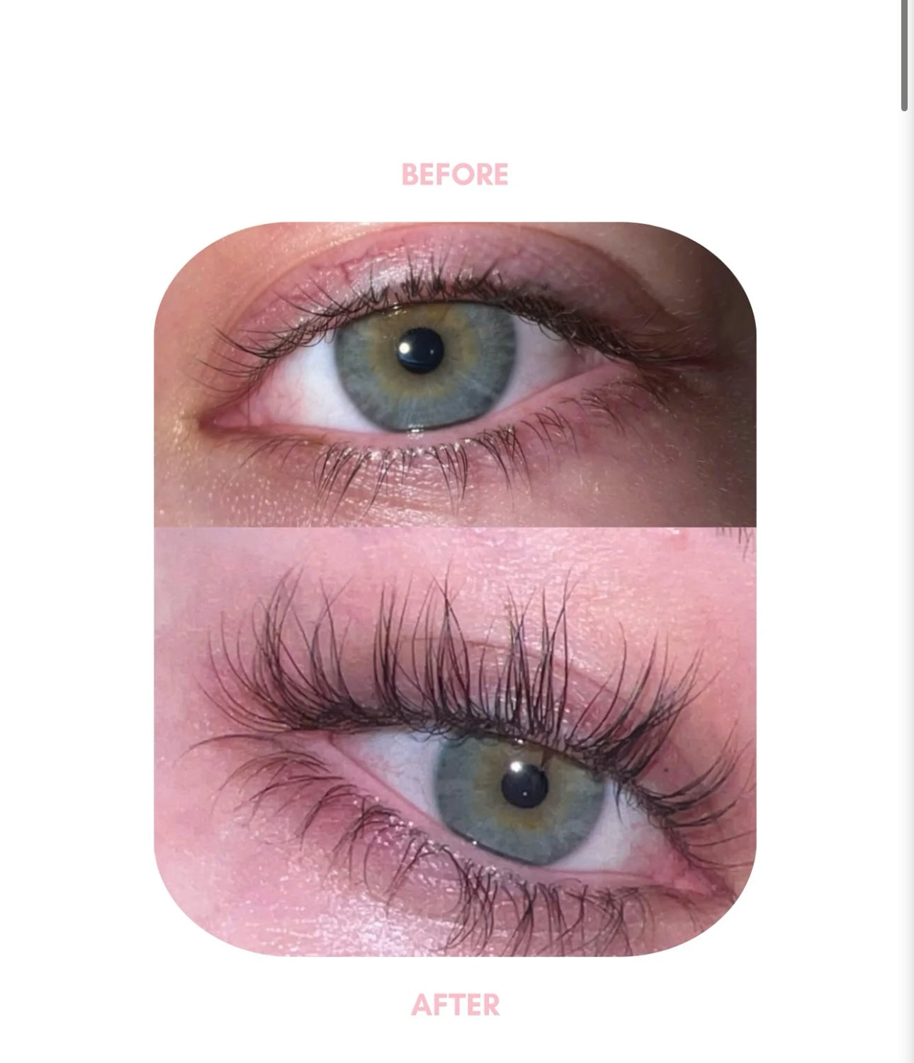 Seurico™ Lash & Brow Serum Fast Growth