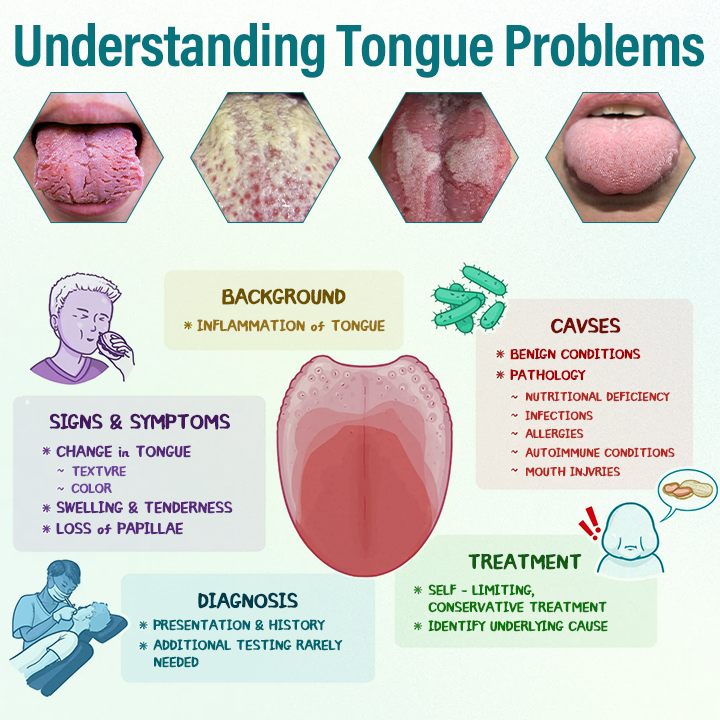 Timiilk® GlosShield Tongue Repair Spray: Fast, Natural Relief for Oral Discomfort