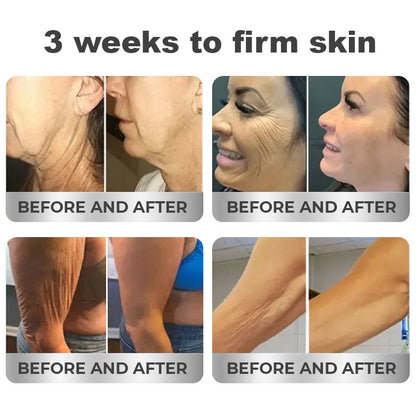 🧬𝑁𝐸𝐺𝑈𝑆𝑌® 𝑃𝑒𝑝𝑡𝑖𝑑𝑒 𝐶𝑜𝑚𝑝𝑙𝑒𝑥 𝐴𝑔𝑒-𝐷𝑒𝑓𝑦𝑖𝑛𝑔 𝑆𝑘𝑖𝑛 𝑅𝑒𝑠𝑡𝑜𝑟𝑎𝑡𝑖𝑣𝑒 𝐶𝑟𝑒𝑎𝑚