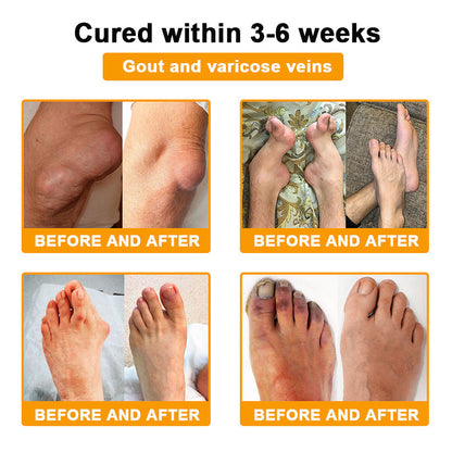 Seurico™ Botulinum Toxin & Bee Venom Pain-Relief Bone Healing Cream (Copy)