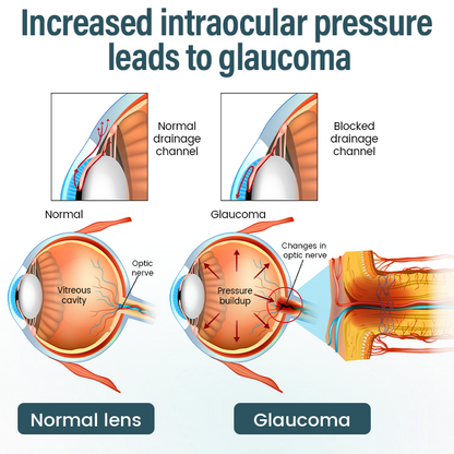 Timllk® OptiFusion Nano Eye Drops Serum