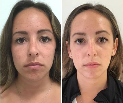 Seurico™™ Power Redo Anti-Aging Blur & Smooth Wrinkle Filler-Last Day Sale 90% OFF 🔥Buy 1 Get 2 Free🔥