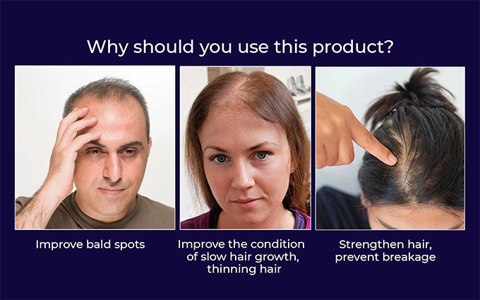 🌿 Odeiun™ Natural Hair Regrowth Spray – 70% OFF Ends Tonight! 🔥