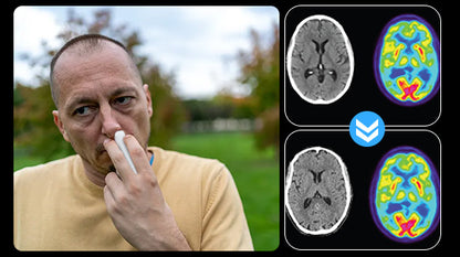 NeuroMist-Memory-Boost(treat Alzheimer's disease)