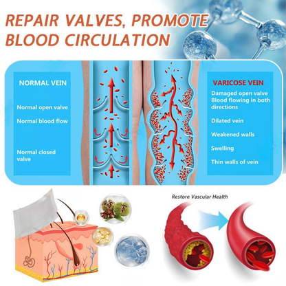 【Last Day Promotion 80% OFF】FDA Official: Seurico™ Vein Ease Microneedle Care Patch(For Spider Veins, Varicose Veins, Swelling & Leg Fatigue)
