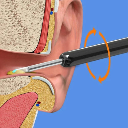 Visual Ear Pick Wireless Cleaning Endoscope HD Earwax Removal Tool