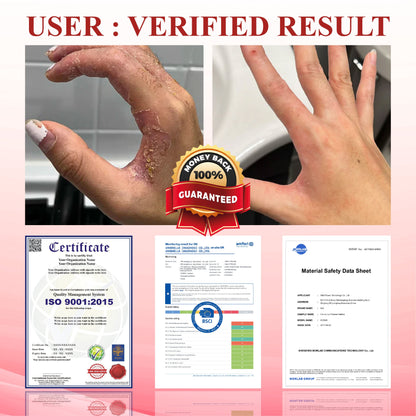 🌱 𝗡𝗘𝗚𝗨𝗦𝗬® 𝗚𝗹𝘂𝗰𝗼𝘀𝗲𝗚𝘂𝗮𝗿𝗱 𝗦𝗸𝗶𝗻 𝗥𝗲𝘀𝗰𝘂𝗲 𝗖𝗿𝗲𝗮𝗺 🌱