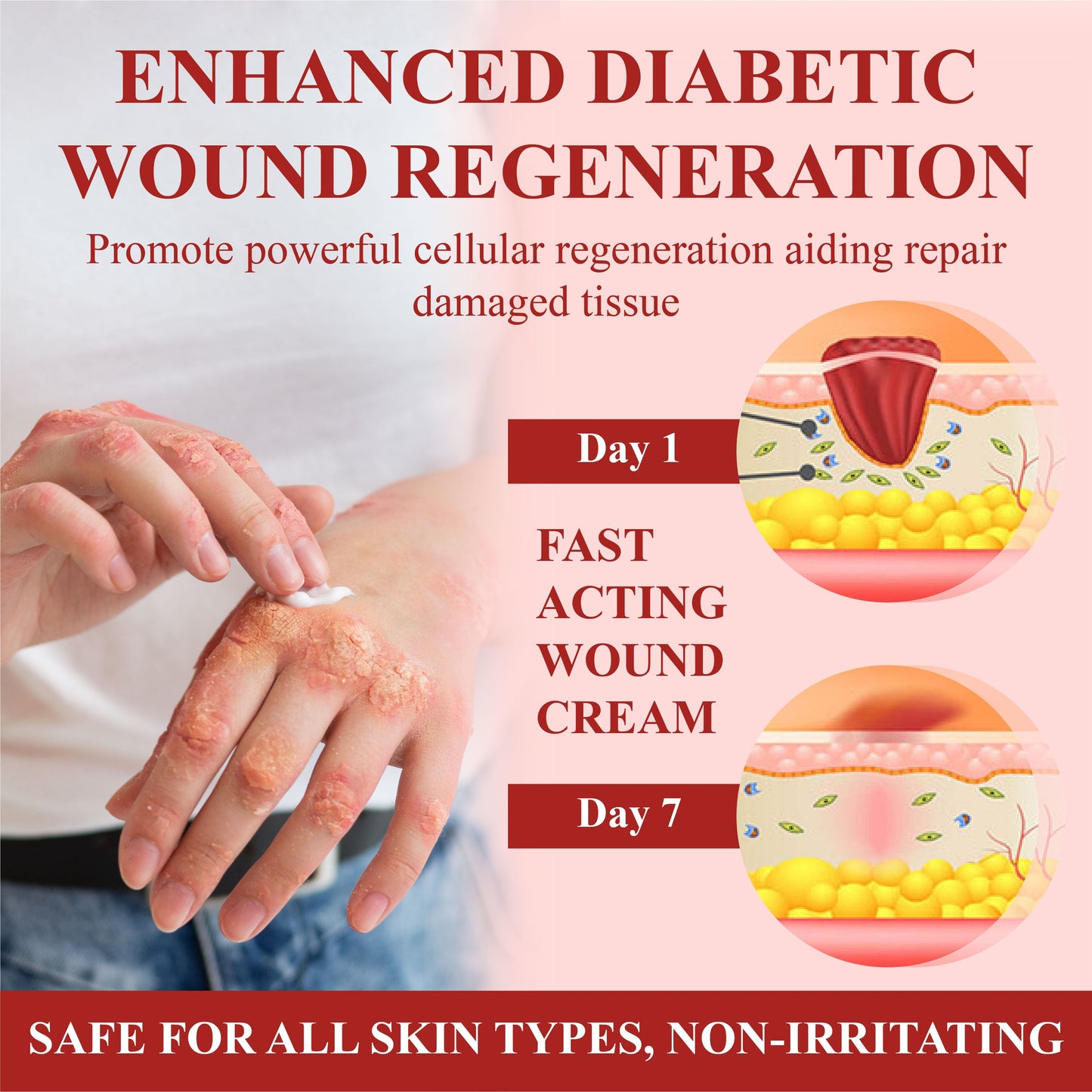 🌱 𝗡𝗘𝗚𝗨𝗦𝗬® 𝗚𝗹𝘂𝗰𝗼𝘀𝗲𝗚𝘂𝗮𝗿𝗱 𝗦𝗸𝗶𝗻 𝗥𝗲𝘀𝗰𝘂𝗲 𝗖𝗿𝗲𝗮𝗺 🌱