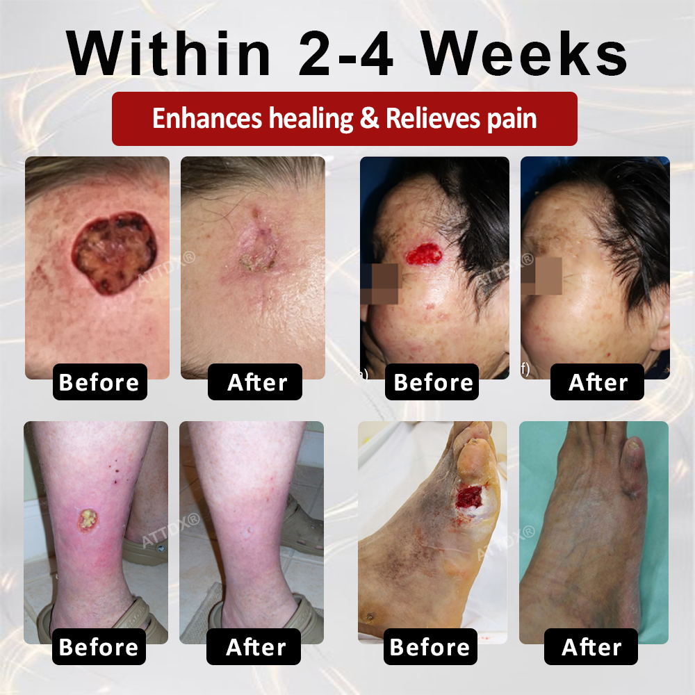 🌱 𝗡𝗘𝗚𝗨𝗦𝗬® 𝗚𝗹𝘂𝗰𝗼𝘀𝗲𝗚𝘂𝗮𝗿𝗱 𝗦𝗸𝗶𝗻 𝗥𝗲𝘀𝗰𝘂𝗲 𝗖𝗿𝗲𝗮𝗺 🌱