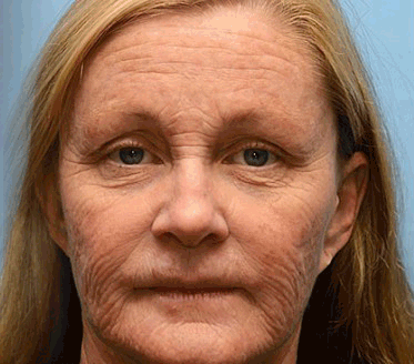 🤍Seurico™ Grass Fed Tallow Balm - 100% Natural Solution for Radiant Skin