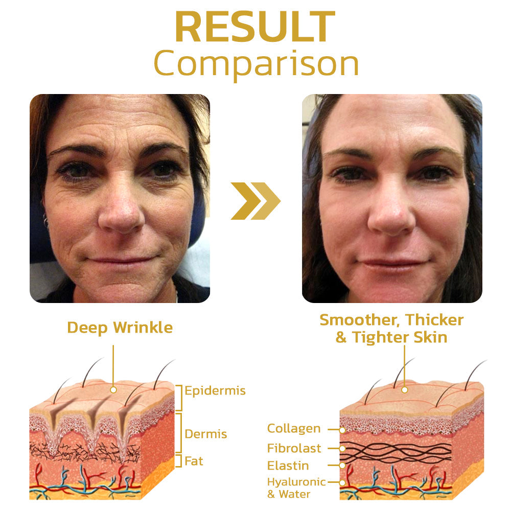 Seurico™ PeptiDew Korean Peptide Deer Bone Soluble Collagen Film