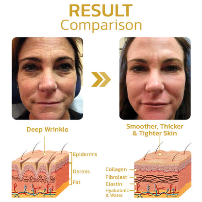 Seurico™ PeptiDew Korean Peptide Deer Bone Soluble Collagen Film