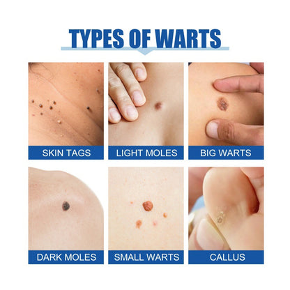 Seurico™ Nevus Removal Cream