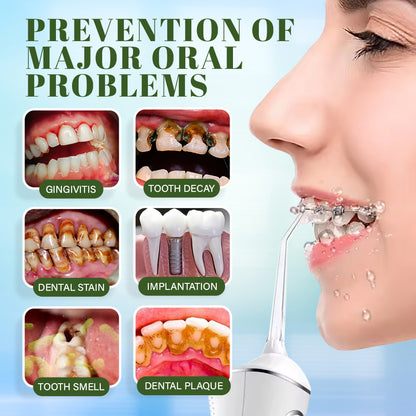 Seurico™ Water Dental Flosser Teeth Pick - Cordless Portable 4 Modes🦷