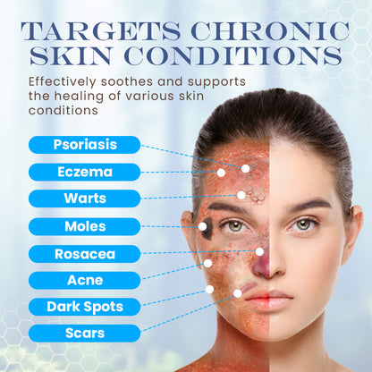 Seurico™ Snail Mucin Skin Treatment Cream (AAD Recommended👨‍⚕️)💖💟