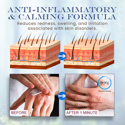 Seurico™ Snail Mucin Skin Treatment Cream (AAD Recommended👨‍⚕️)💖💟