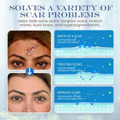 Seurico™ Snail Mucin Skin Treatment Cream (AAD Recommended👨‍⚕️)💖💟