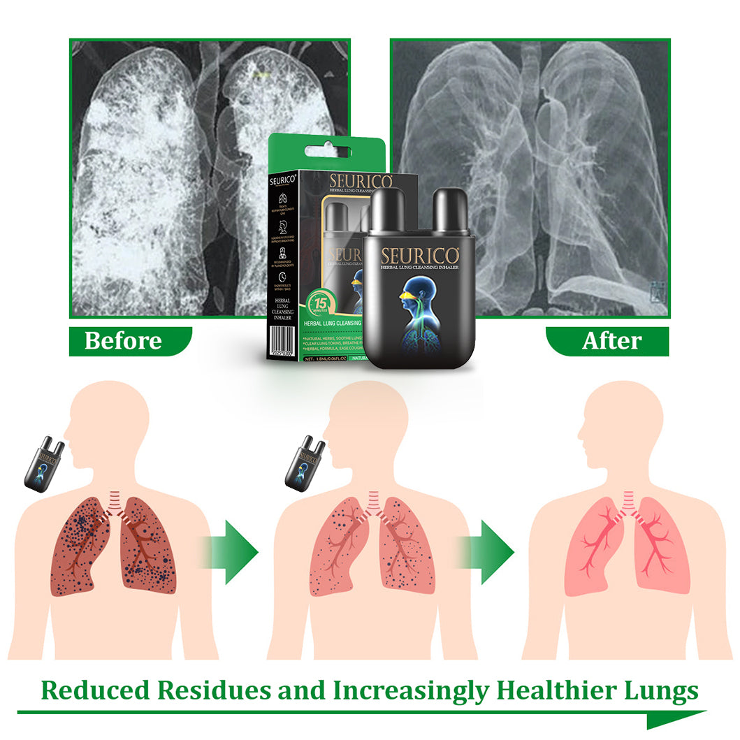 💜✅Official Store Seurico™  herbal lung cleansing inhaler 👨‍⚕️FDA Certification(💝 Cough, wheezing, shortness of breath, sputum, stuffy nose, bronchitis, bronchitis, allergy symptoms, lung discomfort💝)