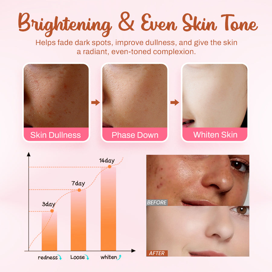 Seurico™ Whitening and Freckle - Removing Mask