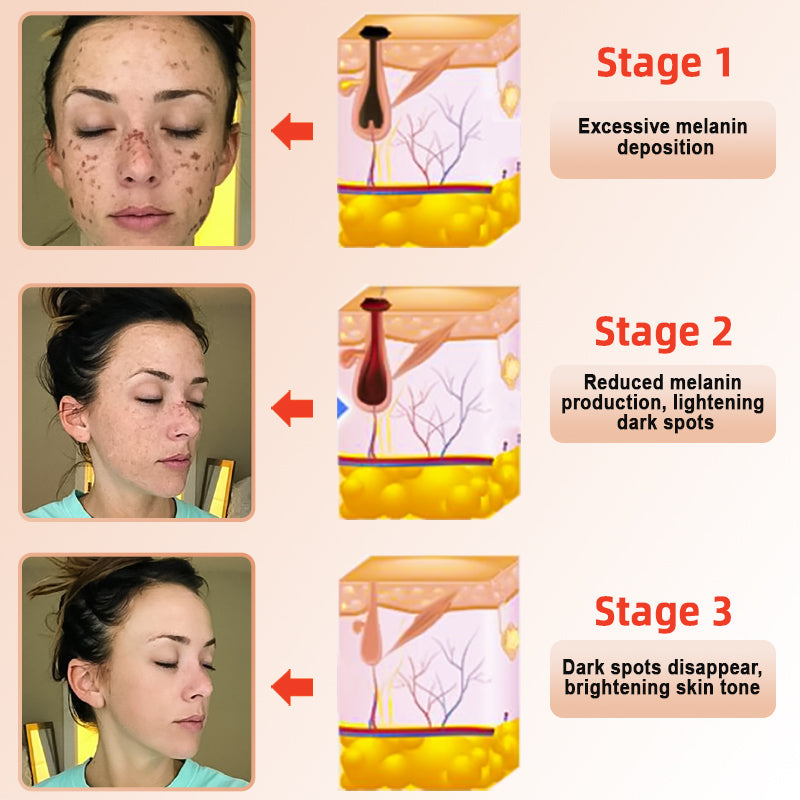 ✨𝐋𝐚𝐬𝐭 𝐃𝐚𝐲 𝐃𝐢𝐬𝐜𝐨𝐮𝐧𝐭: 90% 𝐎𝐅𝐅🔥 Seurico™ Exfoliating Gel