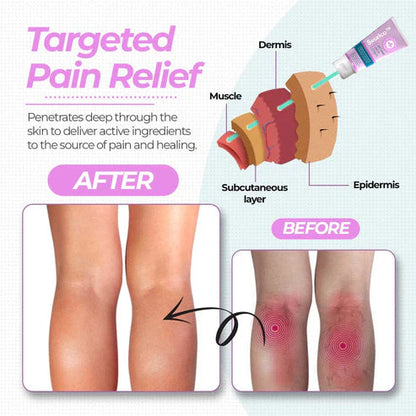 Seurico™ Varicose Veins Cream