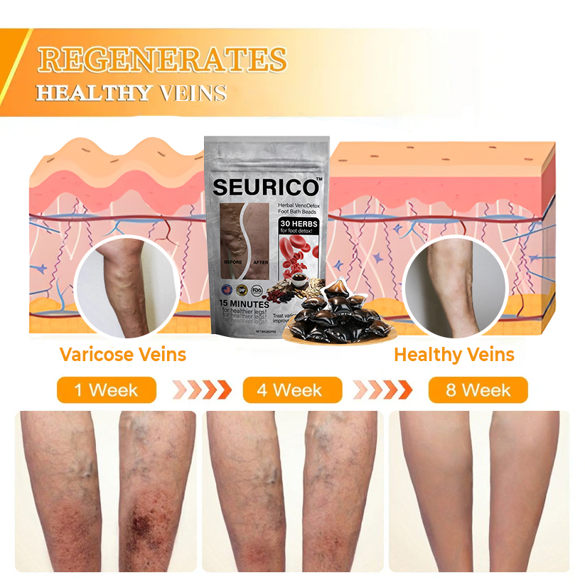 🌿Seurico™ Herbal VenoDetox Foot Bath Beads🌲(𝐋𝐀𝐍𝐀 𝐂𝐞𝐫𝐭𝐢𝐟𝐢𝐜𝐚𝐭𝐢𝐨𝐧，𝗟𝘆𝗺𝗽𝗵𝗮𝘁𝗶𝗰 𝗔𝘀𝘀𝗼𝗰𝗶𝗮𝘁𝗶𝗼𝗻 𝗼𝗳 𝗔𝗺𝗲𝗿𝗶𝗰𝗮)