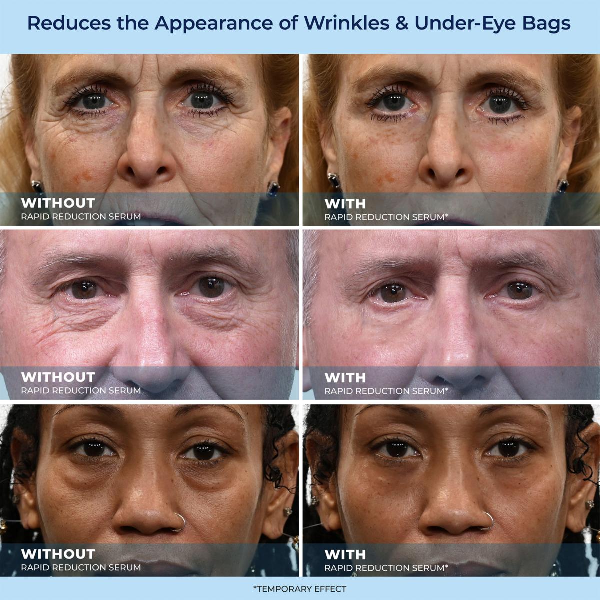 🔵LBMLBM™ 60-Second Anti-Aging Serum for Wrinkles, Bags & Dark Circles