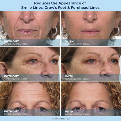 🔵LBMLBM™ 60-Second Anti-Aging Serum for Wrinkles, Bags & Dark Circles